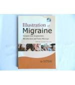 Illustration of Migraine Treated with Acupuncture, Moxibustion and Tuina Massage (cod C02)