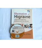 Illustration of Migraine Treated with Acupuncture, Moxibustion and Tuina Massage (cod C02)