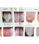 Chart of tongue diagnosis in TCM (code H14)