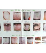 Chart of tongue diagnosis in TCM (code H14)