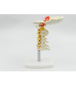Cervical spine with vertebral artery (code S18)
