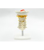 Cervical spine with vertebral artery (code S18)