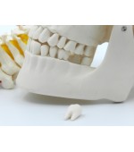 Human skull (code S24)