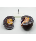 Human kidney model - 2 parts (code S35)