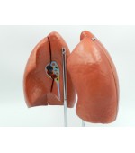 Human lung model - 4 parts (code S39)