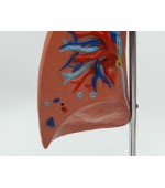 Human lung model - 4 parts (code S39)