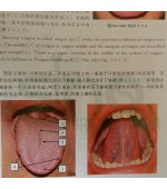 Tongue figure in Traditional Chinese Medicine (cod C112)