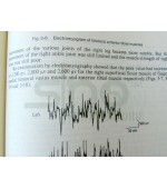 Scalp Acupuncture and Clinical Cases (cod C107)