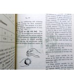 Chinese Acupuncture and Moxibustion (cod C93)