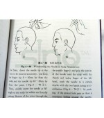 Skills of Chinese Acupuncture and Moxibustion (cod C84)