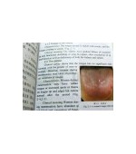 ILLUSTRATIONS of TONGUE diagnostics (cod C78)
