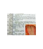 ILLUSTRATIONS of TONGUE diagnostics (cod C78)