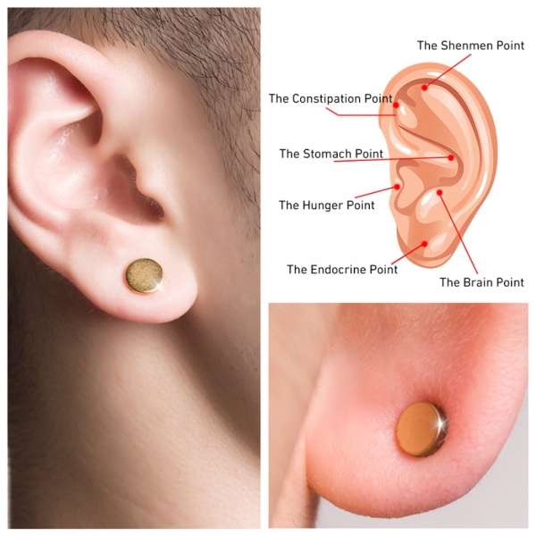 Magneți de slăbire - Magneți urechi de pierdere în greutate