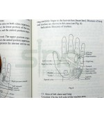 Hand Acupuncture Therapy (cod C25)