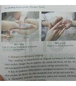 Three-Character-Scripture School Pediatric Massage (cod C33)
