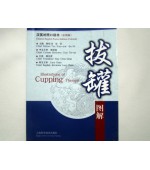 Illustration of Cupping Therapy-pocket edition (cod C28)