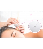 Lumanare terapeutica pentru urechi (cod R17)
