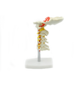 Coloana cervicala cu artera vertebrala (cod S18)