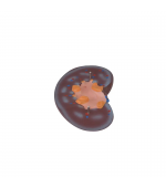 Human kidney model - 2 parts (code S35)